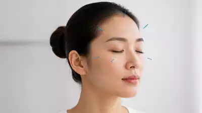 Acupuncture points focus for eye health