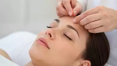 An acupuncture session focusing on eyes