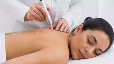 Laser-Augenakupunktur Anwendung