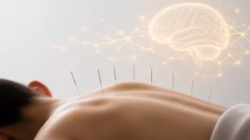 Akupunktur und neurologische Erkrankungen